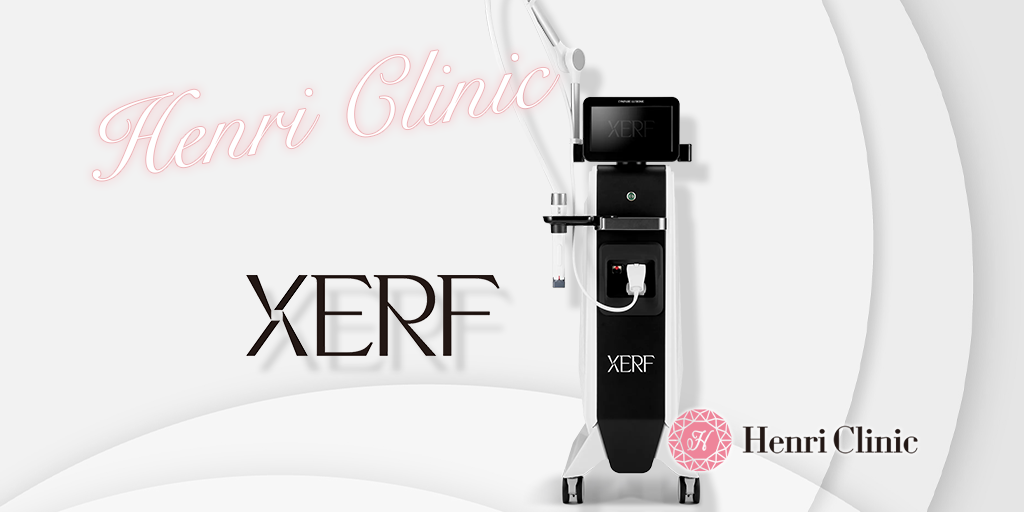 ザーフ（XERF）