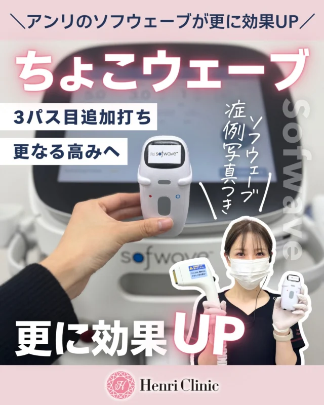 ＼アンリのソフウェーブが更に進化／
その名も “ちょこウェーブ”🔥

「しっかり効かせたい」
「あとひと押し欲しい」
そんな方のための 3パス目追加打ちメニューが登場しました✨

【ちょこウェーブとは？】
🔥 ソフウェーブ通常2パスのあと、気になる部位をさらに1パス追加照射
🔥たるみ・フェイスラインの“重ね打ち“でより高い効果
🔥痛みは通常ソフウェーブと同等
🔥ダウンタイムほぼなし
🔥引き上がり実感がさらにUP⬆

こんな方におすすめ😊
・頬のもたつきが気になる
・ほうれい線を浅くしたい
・フェイスラインをシャープにしたい
・ソフウェーブの仕上がりをもっと高めたい
・口ポニョが気になる

症例あり📸
実際にメニュー化するまでに行ったスタッフへの照射でも「引き上がり方が全然違う」と大好評です✨

【価格】
🔥＋16,500円
※通常のソフウェーブ施術に追加するオプションです

✔ 予約方法
プロフィールTOPのURLから
【Web予約】へ🗓

📍アンリクリニック名古屋院
🕊最新のたるみ治療から美肌治療まで
患者さまに合わせた治療をお選びいただけます✨

施術メニュー：ソフウェーブ全顔あご下
⁠施術間隔：半年～1年前後
リスク・副作用：赤み・むくみ・火傷など⁠
ダウンタイム：むくみ、赤み、腫れなど⁠
治療価格：99,000円

※効果には個人差がございます

#ソフウェーブ#たるみ治療