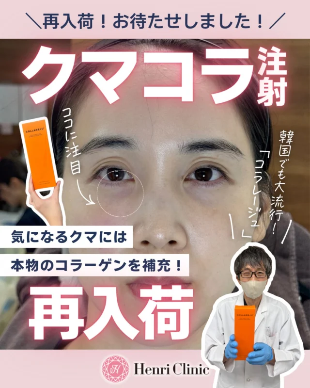 ＼ お待たせしました！／
大人気 “クマコラ注射” が再入荷しました🧡✨🐻

目の下のクマ・くすみに悩む方から
ずっとお問い合わせが続いていたコラージュ製剤💉
今回はデバイス治療で注入が可能になりました✨

目の下のクマにはDr施術🥼
お肌全体を美肌にしたい方はNs施術🏥

本物の“コラーゲン注入”一歩先の美肌に✨

▶ 韓国でも大流行の「CollaReju（コラレージュ）」使用
▶ なめらかで自然な仕上がり
▶ 皮膚の薄い目元にも相性◎
▶ ヒアルロン酸では出せない“質感の改善”に強み

「クマが気になる」
「目元が疲れて見える」
「ヒアルロン酸は怖かった」
「お肌もコラーゲンで綺麗にしたい」
そんな方にも選ばれています👀✨

数量に限りがありますので、気になる方はお早めにご連絡くださいませ📲

📩 ご予約・お問い合わせはDM / LINE へ
📍 アンリクリニック名古屋院

#クマコラ注射 #コラレージュ #クマ治療 #アンリクリニック名古屋院