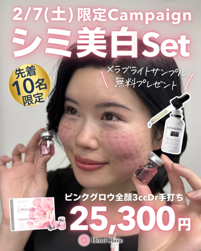 ✨2/7（土）先着10名様限定！メラブライト無料プレゼント✨

シミ美白セット｜先着10名様🫧

シミ・肝斑治療、レーザーだけが正解ではありません！

💉ピンクグロウ注射は
50種類以上の有効成分を配合した
✨先進的な美白カクテル注射✨

肝斑・色素沈着・くすみに
「肌そのものの代謝」からアプローチします😍

今回は特別に👇
🎁 メラブライト3gサンプルを無料プレゼント

🩷 セット内容
・ピンクグロウ全顔3cc（Dr手打ち）

💰 価格
¥44,000 → ¥25,300
※別途麻酔代 ¥2,200

✅ こんな方におすすめ
✔ 肝斑・シミがなかなか改善しない
✔ レーザー以外の選択肢を探している
✔ 透明感・トーンアップしたい
✔ ピコやシミ取り後の色素沈着が心配

📅 2/7（土）限定
👤 先着10名様
📲 ご予約はWEBから受付中

※効果には個人差があります