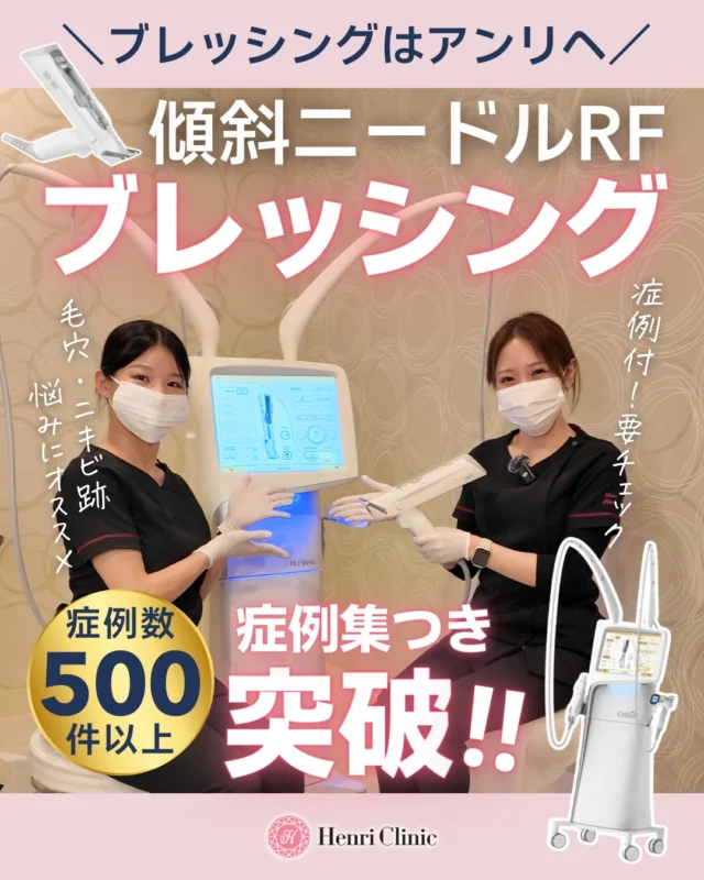 🎉症例数500件突破🎉
傾斜ニードルRF「ブレッシング」🔥

アンリのブレッシング🏥
導入4か月間でついに症例500件以上📈✨

積み上げてきた数＝技術力💁
だから結果に差が出ます✨

🔥ブレッシングの強み
✔ 傾斜ニードルで熱を効率よく拡散
✔ 高周波エネルギーで真皮リモデリング
✔ 皮脂腺抑制でニキビができにくい肌へ
✔ 薬剤同時注入で相乗効果💉✨

平均1000shot以上（※当院平均）
少ない回数でも変化を実感しやすい設計です😊

3回施術で
✔ クレーター改善
✔ 赤み軽減
✔ 毛穴引き締め
✔ たるみまでアプローチ

“安いだけ”ではありません👏
症例が集まるからこそ、技術が磨かれる💙

━━━━━━━━━━━━━━
📌2月キャンペーン実施中
ブレッシングALL25％OFF

※麻酔代別途
※効果には個人差があります
※副作用：発赤・腫脹・乾燥など
※施術費用：モニター様1回49,500円

━━━━━━━━━━━━━━

毛穴・ニキビ跡を本気で改善したい方はまずはカウンセリングへ🩺

ご予約はプロフィールリンクから📲✨

#ブレッシング