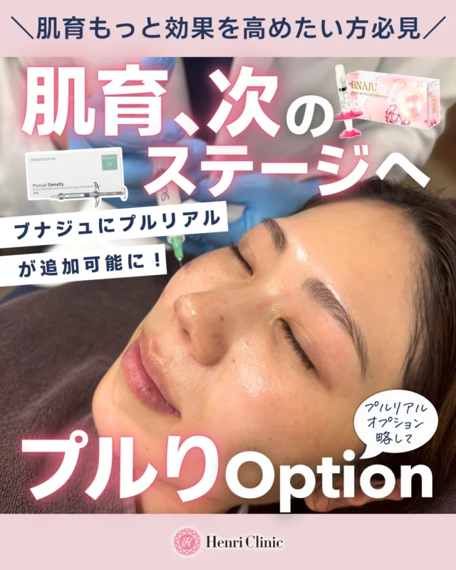 肌育、次のステージへ🔜🕊️

肌育を続けている方ほど、こんな感覚ありませんか？

悪くないケド、あと一歩足りない🙄

その“あと一歩”を埋めるのが
今回の🐟プルりオプション🐟です✨

大人気のBNAJUは肌の土台自体を整えます🌱
そして今回のプルりoptionは肌育注射プルリアルデンシファイをMIXして組み合わせることで相乗効果が期待できる治療です💉🔥

✔ ハリ感の底上げ
✔ 年齢肌を元気に
✔ 赤み・炎症の回復サポート

“仕上がりの質”が変わります💁‍♀️

単体でもどちらも十分良い施術ですが、組み合わせることで完成度は明確に変わってくる😳😳😳

📅期間限定キャンペーン🔔

☑️通常価格
BNAJU+ プルリアルデンシファイ2cc
合計 ¥121,000
👇
✅キャンペーン価格
¥77,000（税込）

【BNAJU単品】
こちらもなんと特別価格を実施✨
1回　¥55,000（税込）

※スキンプラスでも可能です
※先着20名様限定💨
※4/20〜4/25まで

💡こんな方に
・肌育しているが物足りない
・ハリ・ツヤをもう一段階上げたい
・赤みや炎症を抑えたい

🇰🇷施術後のダウンタイムを最小限に抑える
LDM鎮静セット割も登場🈹

赤みや内出血の引きをよくする効果＆やわやわ赤ちゃん肌に仕上げます👶🏻

🔔同時セット割
LDM1回全顔　＋¥9,900

ご予約はプロフィールのリンク or 公式LINEより
「プルりオプション」特設会場よりご予約くださいませ💉💁‍♀️