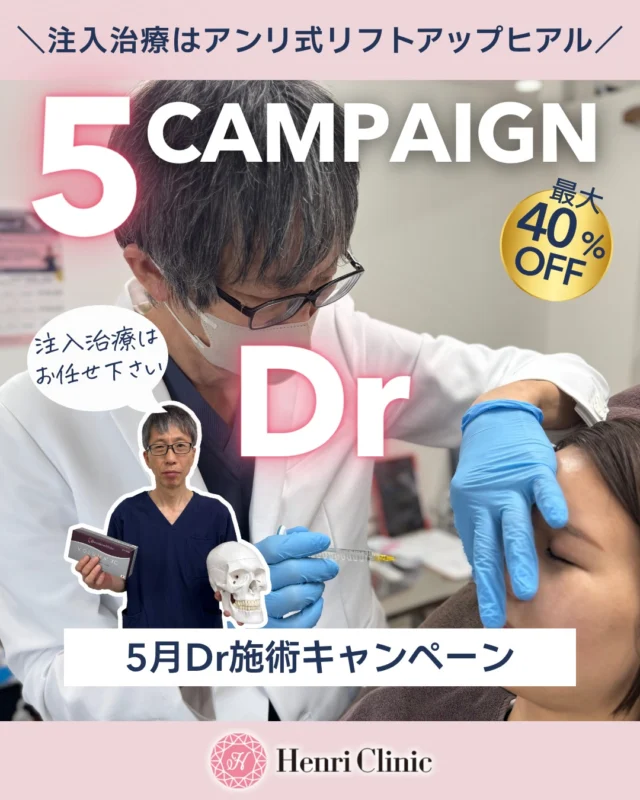 注入施術といえばアンリ式💉

5月キャンペーン情報解禁🔥
GWはGOGOアンリキャンペーンを開催💖

今回の目玉メニューは・・・
やっぱりアンリと言えば・・・
💉アンリ式リフトアップヒアル🥼

当院のヒアルロン酸は単なるボリューム補充ではなくたるみを原因からキュッとリフトアップさせる独自の注入方法を行います😎

✔ 支持構造を再建
✔ フェイスラインを引き上げ
✔ 自然な変化で仕上げる

そんな方はアンリ式リフトアップヒアルをお選び下さいませ🍀
院長の徐先生が診察から処置まで担当いたします🥼

更に更に・・・今回はリフトアップヒアルを受けた方限定の特典あり🚨

▼リフトアップヒアル限定特典
① エムフェイス（お顔の筋トレ×引き締め）特別価格
👉 エムフェイスで注入前にお顔の筋トレ
② LDM（アンリプログラム）特別価格
👉 LDMで痛みレスの美肌リフティング

結果を最大化するための設計にしています😎

✅お悩み別注入施術
・スキンバイブで乾燥肌におさらば
・ヒローウェーブで首のシワ改善
・クマコラで凹みクマアプローチ

✅肌育取り揃え種類NO.1✨

✅将来への投資はボトックス

✅最新の肌育「ブナジュ&スキンプラス」も特別価格
今回はプルリアルデンシファイオプションと目周りオプションが新たに登場👀

GWGOGOキャンペーン🎏
対象期間：5/1～5/31

「たるみ・しわ」に特化した注入専門と言えばアンリ式にお任せ下さい🏥

▼予約方法
・WEBまたはLINEまで（プロフィールリンク）

#アンリクリニック名古屋院