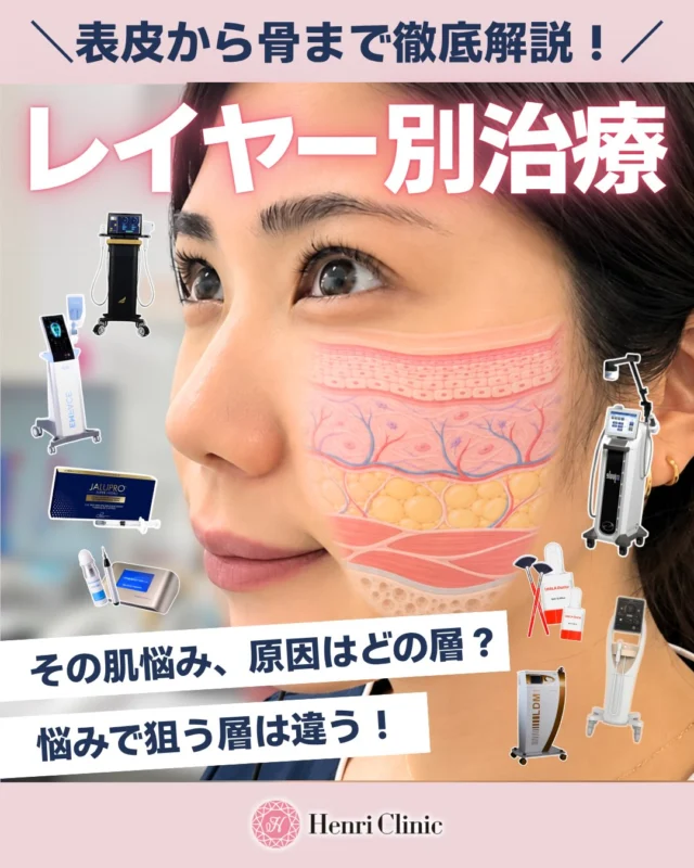 ＼その肌悩み、原因はどの層？🔍／

一言で「肌悩み」といっても、
実は原因となる“レイヤー”はさまざま。

✔ 表皮
✔ 真皮
✔ 皮下脂肪
✔ 筋膜・筋肉
✔ 骨

お肌は表面だけではなく、いくつもの層から成り立っており、
どの層に原因があるかによって、適したアプローチも異なります🫧

Henri Clinicでは、肌状態やお悩みを確認しながら
一人ひとりに合わせた治療をご提案しています。

今回の投稿では、
表皮から骨まで、それぞれの層の役割・お悩み・おすすめ施術をまとめました✨

「たるみには何を選べばいい？」
「毛穴やハリ不足はどの層が関係してる？」
「自分にはどの施術が合っているかわからない…」

そんなときの参考に、ぜひ保存して見返してください📖♡

気になる施術については、お気軽にご相談ください。

※効果・経過には個人差があります。
※施術には副作用・リスク・ダウンタイムが生じる場合があります。
※適応となる施術は肌状態やお悩みによって異なります。