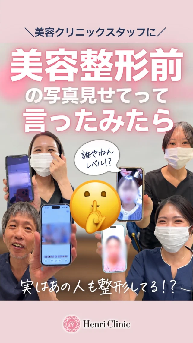 美容クリニックスタッフに整形前の写真見せてって言ったら🤫🤳🏻

みんな別人級！？
ちゃーんとキレイになってる💕😌

スタッフ自身が美容医療を受けてきたからこそ、リアルなご相談に乗れます🙋‍♀️
美容のことはアンリにご相談下さい✨

美容整形していると人！
過去に受けた施術をコメント欄で教えて💭👇

#美容整形 #ダウンタイム