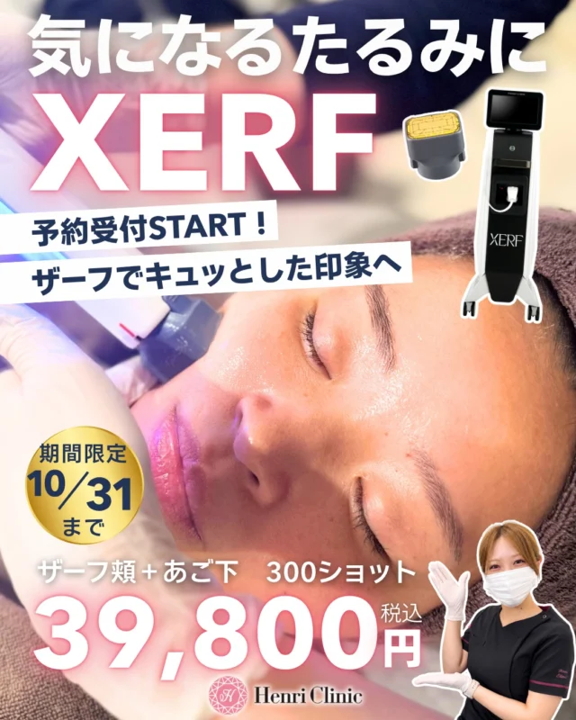 ザーフ予約受付再開しました👑

気になる頬・フェイスラインのたるみに🌿

一時的にご予約が増えすぎて受付停止をしておりました🙇‍♀️
無事チップ入荷が完了したため、XERF（ザーフ）のご予約を受付開始しました✨

ザーフは、高周波（RF）を用いて肌の引き締めを図る施術です💁
お肌の状態やご希望を診察で確認し、施術の適応をご案内いたします。

こんな方にご相談いただいています💭
▫️頬やあご下のたるみが気になる方
▫️フェイスラインの変化が気になる方
▫️切開を伴わないたるみ治療を検討している方

📍ザーフ料金案内
頬＋あご下／300ショット
1回 39,800円（税込）

全顔＋あご下／400ショット
1回 49,800円（税込）

👑ザーフアドバンス
エキスパートナースが施術対応します💗
全顔＋あご下／600ショット
1回 79,200円（税込）

期間：2026年10月31日まで
✅初診料・診察料０円

────────────
〈施術について〉
・自由診療のため、健康保険は適用されません。
・治療期間・回数：1回
・主なリスク・副作用：赤み、腫れ、痛み、熱感、やけど、色素沈着など。
・効果や経過には個人差があります。診察の結果、施術をお受けいただけない場合があります。

〈使用機器について〉
〈未承認医療機器について〉
XERF（ザーフ）は、日本国内では医薬品医療機器等法上の承認を取得していない医療機器です。

〈入手経路〉
当院医師の責任のもと、ルートロニック社を通じて個人輸入しています。
個人輸入に伴うリスクについては、厚生労働省の案内をご確認ください。
https://www.yakubutsu.mhlw.go.jp/index.html

────────────

ご予約・お問い合わせは、プロフィールのLINE／WEBよりお願いいたします📩

🏥アンリクリニック名古屋院
名古屋市中区栄3丁目6-20 辰晃ビル9F