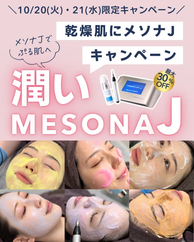 💗 10/20(火)・21(水)限定｜潤いメソナJキャンペーン 💗
乾燥・艶不足・肌荒れが気になりやすい季節に🍂
2日間限定で、メソナJの人気メニューを特別価格でご案内します✨
メソナJは、エレクトロポレーションを用いて美容成分を肌に導入する施術です💖
お悩みに合わせてメニューを選べるので、乾燥・くすみ・毛穴・赤みなど、その日の肌状態に合わせたケアにおすすめです💁
今回の対象メニューはこちら👇
💜 プレミアムリジュビネーション（Purple）
23,100円 → 16,500円
🩷 トータルアンチエイジング（Pink）
19,800円 → 14,300円
💙 肌再生・たるみしわ（Blue）
15,400円 → 12,100円
🤍 肝斑・シミ・美白（White）
14,300円 → 9,900円
🧡 ニキビ・赤み（Orange）
13,200円 → 9,350円
💛 毛穴・美肌（Yellow）
12,100円 → 8,800円

さらに、肌状態に合わせた薬剤導入メニューも対象です✨
・リジュメソ（リジュラン）
22,000円 → 14,300円
・ララメソ（ララブースター）
23,100円 → 16,500円

そして、メソナJと合わせて受けたい方にはピーリングセット価格もご用意しました👏
🫧 ララドクター 全顔1回
通常11,000円 → メソナJとセットで ＋7,700円
🫧 アクアピール 全顔1回
通常8,800円 → メソナJとセットで ＋5,500円

ピーリングや毛穴洗浄のあとにメソナJを組み合わせることで、つるんとした艶肌ケアをしたい方にもおすすめです
❤️

📅 対象期間：10/20(火)〜10/21(水)の2日間限定
📱 適用条件：当院Instagramアカウントのフォロワー様
ご予約はWEBより受付中です。
※本投稿は美容医療施術のご案内です。美容液・薬剤等の単体販売ではありません。
※自由診療です。
※施術の適応は肌状態等を確認のうえ判断します。
※効果・経過には個人差があります。
※施術後に一時的な赤み、刺激感、乾燥等が生じる場合があります。